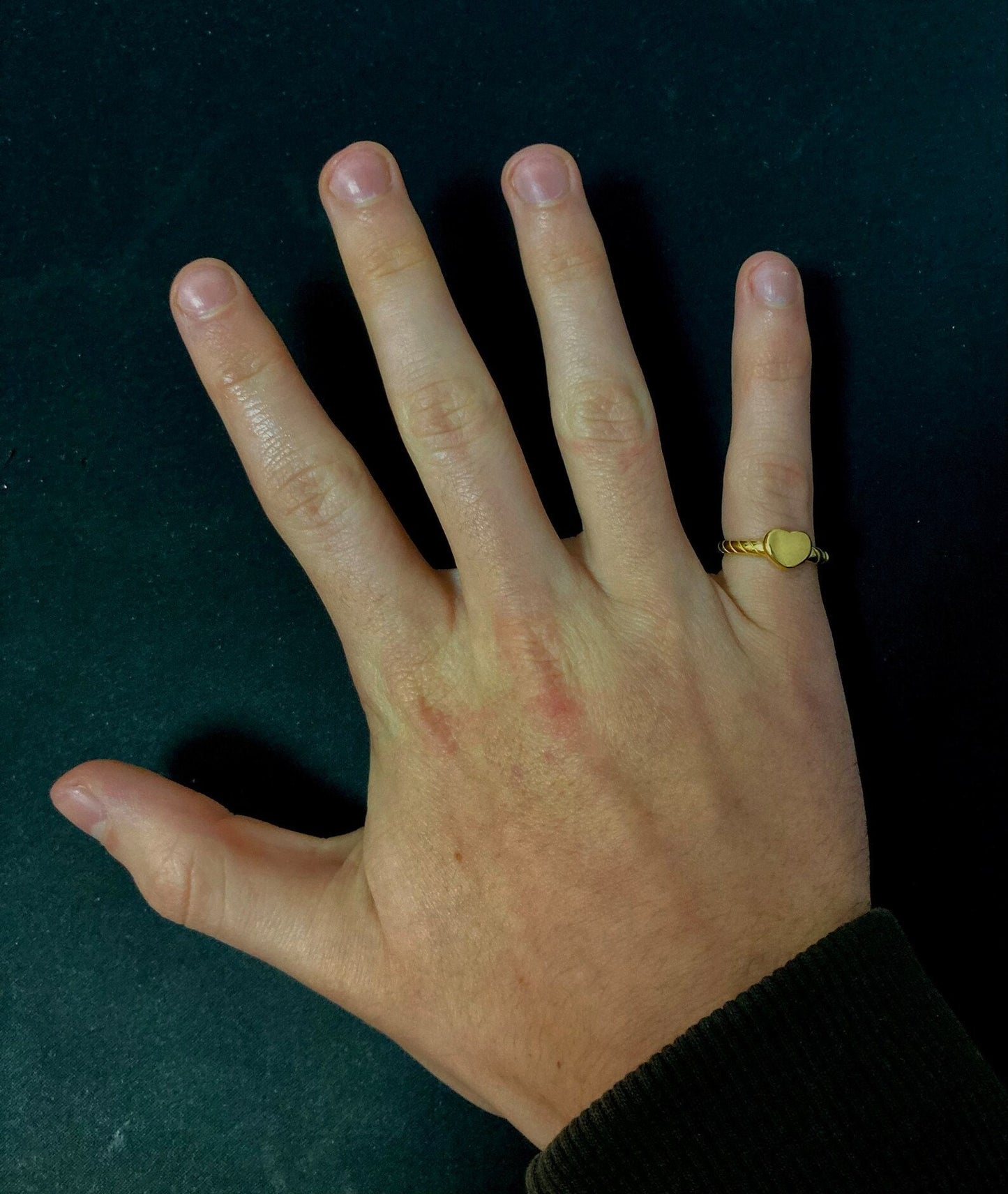 Herzring