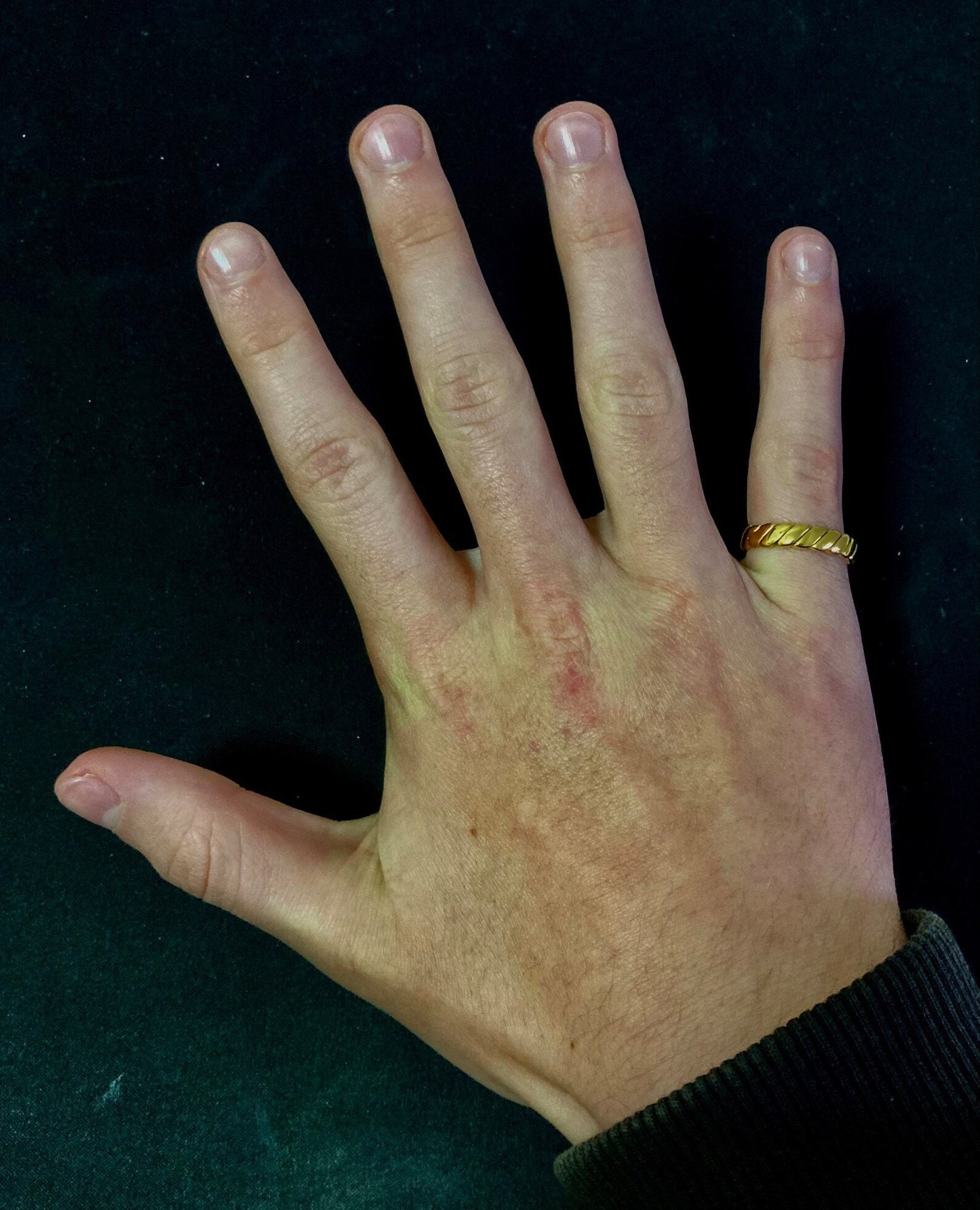 Snake Ring